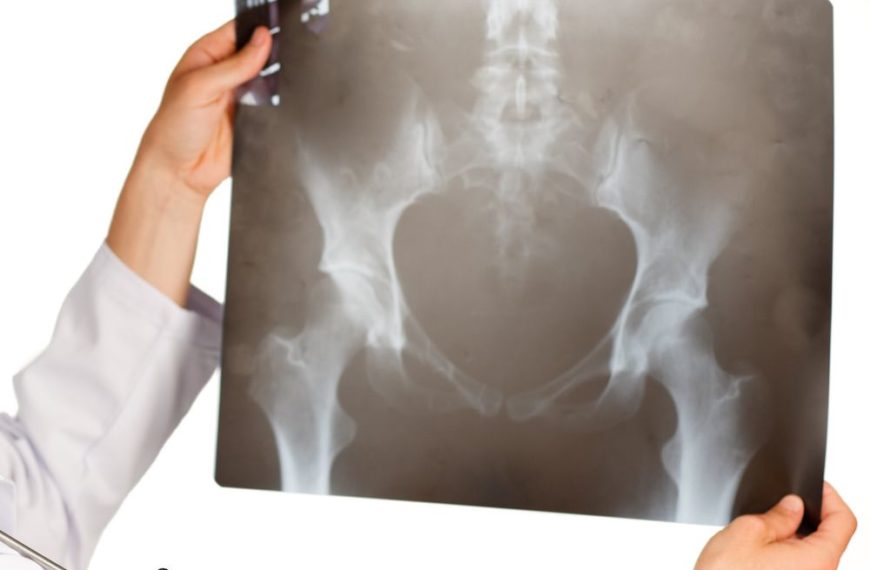 È sicuro fare una radiografia durante la gravidanza?